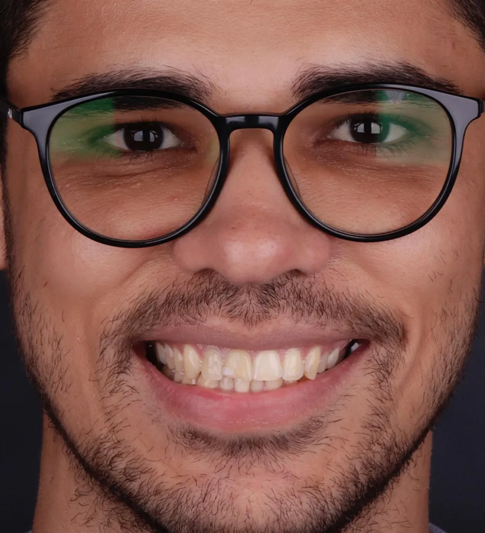 Antes - Transformação 3